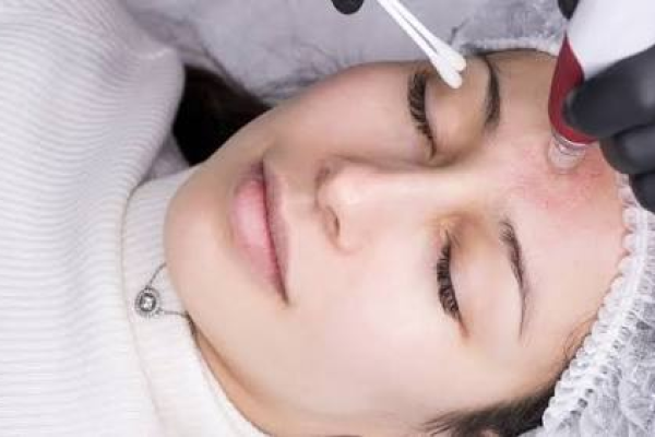 Mesotherapy Treatment: Benefits, Costs, and Risks