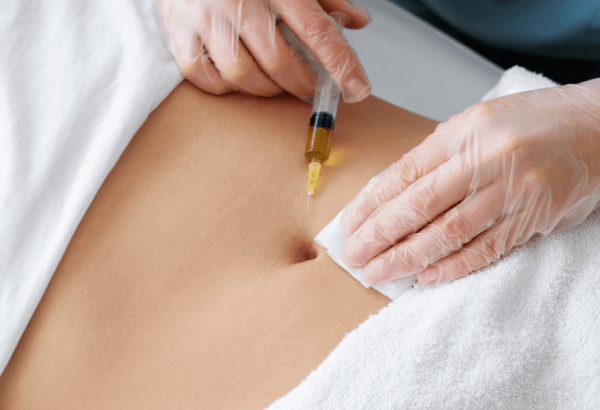 Are Fat Injections Effective for Facial Rejuvenation?