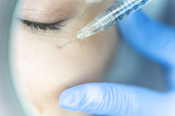 What is the science behind Under Eye Fillers in aesthetics