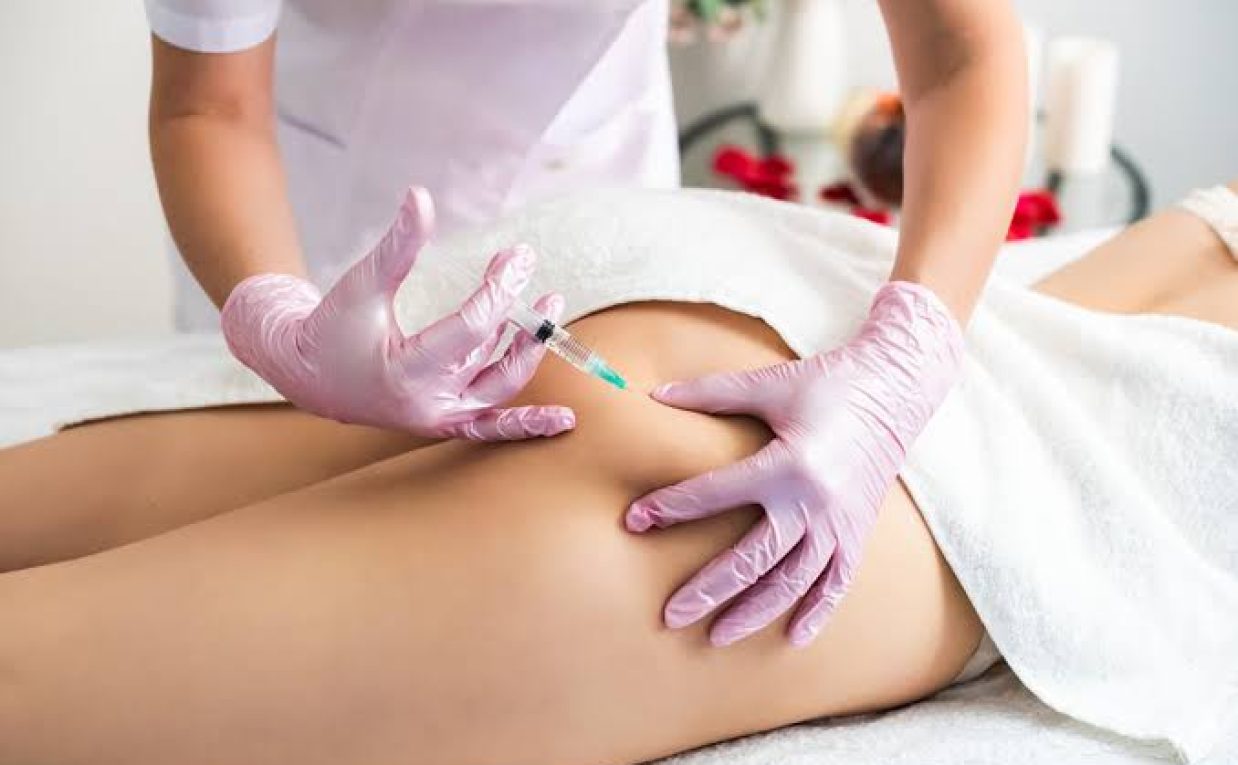 Understanding Butt Fillers in Modern Aesthetic Care