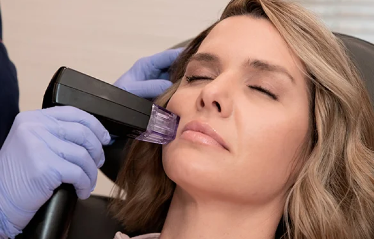 What Areas Can Be Treated with Morpheus8?
