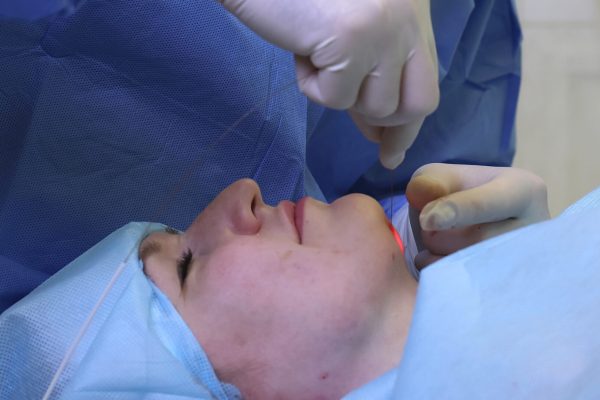 Can Endolift Tighten Loose Facial Skin?