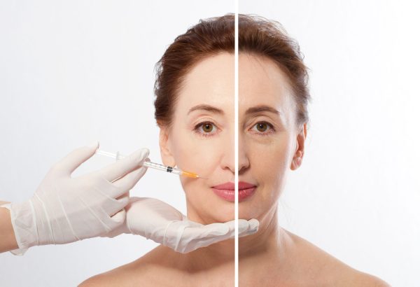 Top Benefits of Choosing Enfield Royal Clinic for Dermal Fillers