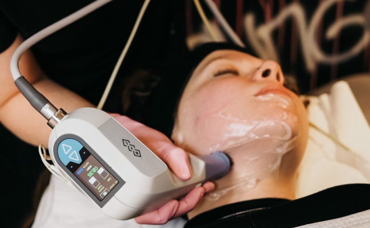 Does Exilis Treatment Require Multiple Sessions?