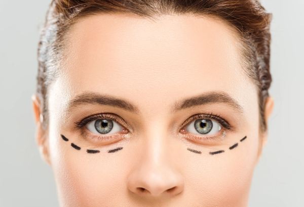 Advanced Solutions for Eye Bag Removal in Dubai