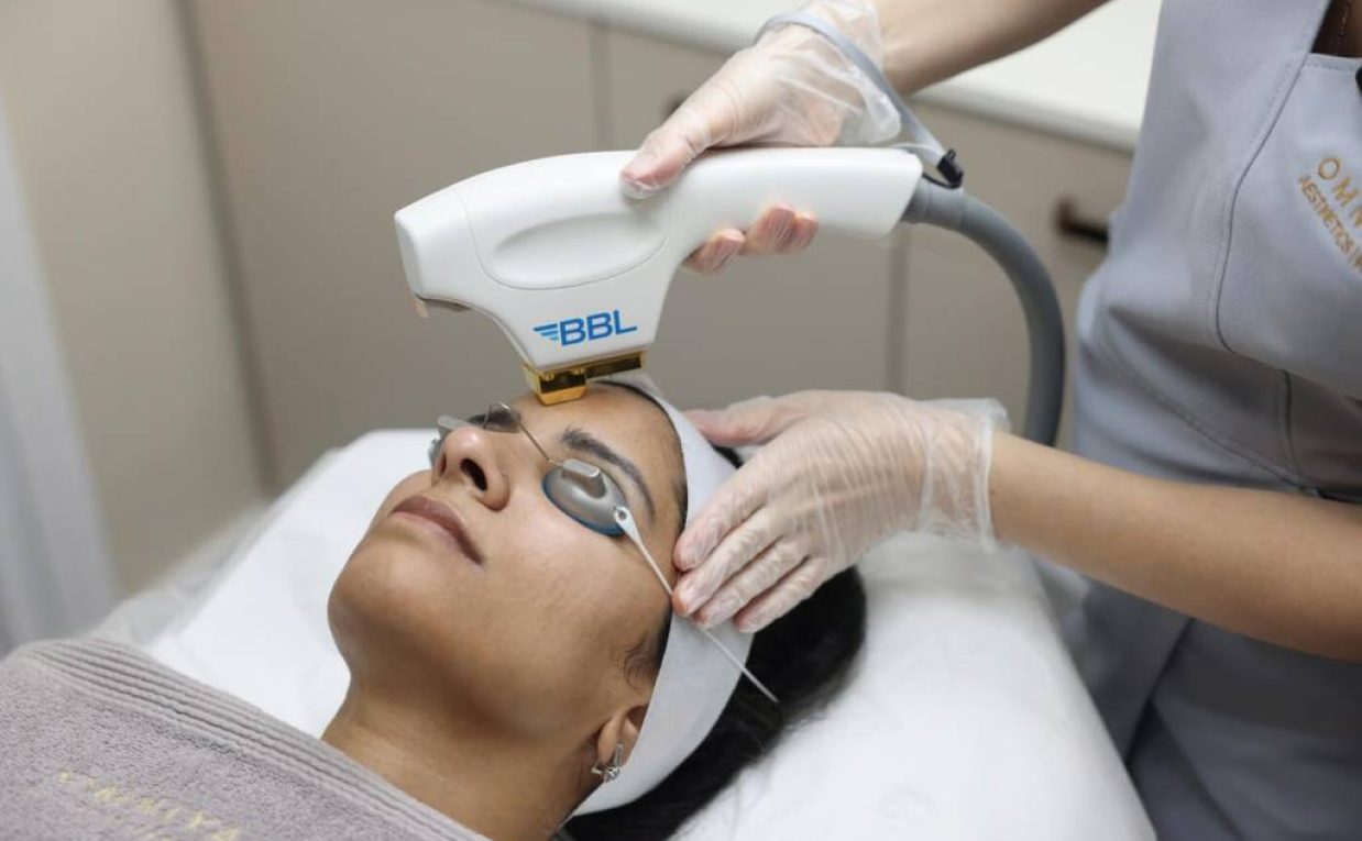 How Best Pigmentation Treatment Is Chosen for Patients