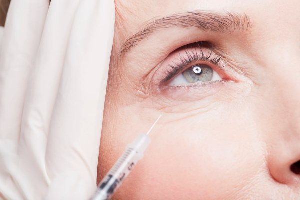 Which Treatment Works Best for Under-Eye Dark Circles?