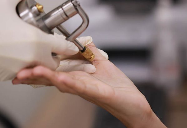 What Are the Key Benefits of Cryosurgery?