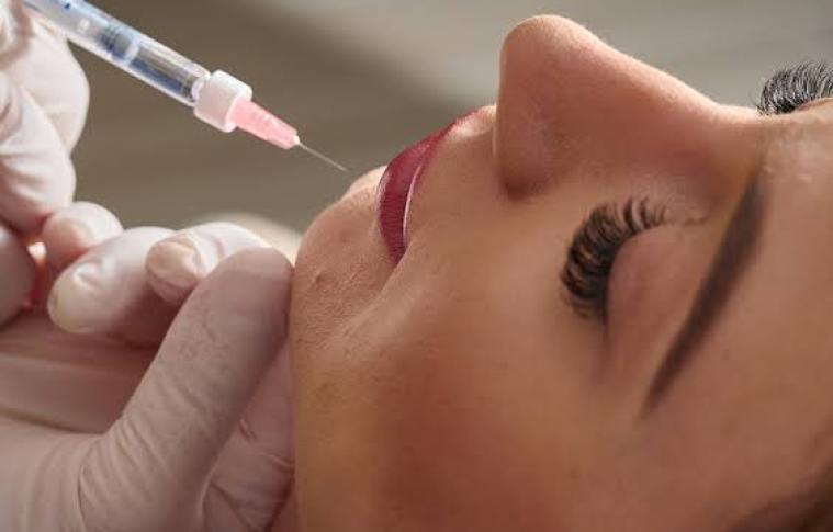 Affordable Lip Fillers Injection Near You Guide