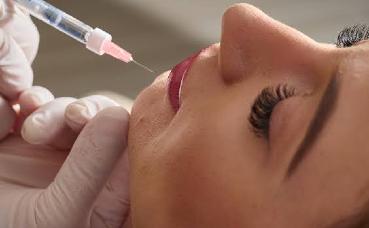 Affordable Lip Fillers Injection Near You Guide