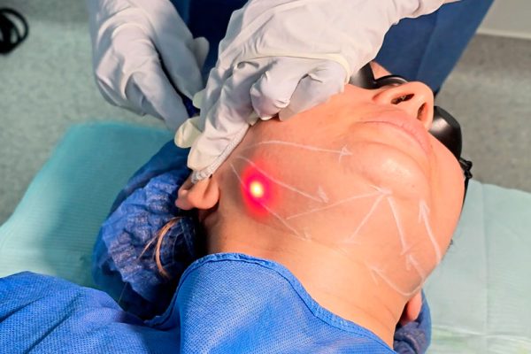 Clinics Known for Natural Results in Endolift in Dubai