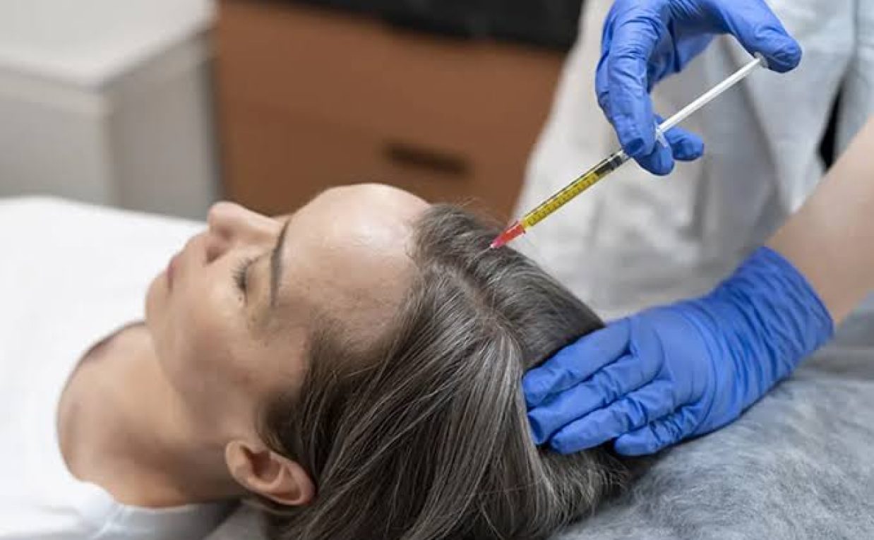 How Is PRP Hair Treatment Integrated Into Hair Care?