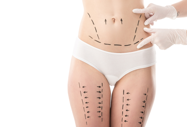 How Long Has Lower Body Lift Surgery Been Performed?