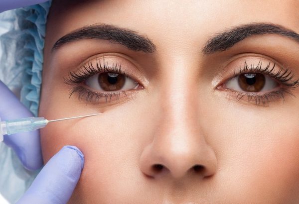 Who Benefits Most from Under Eye Fillers?