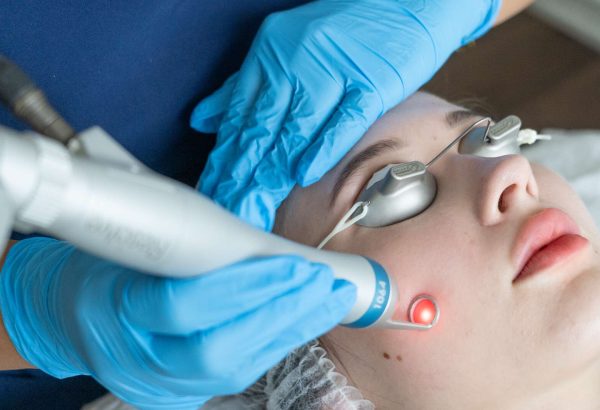 Can Fractional CO2 Laser Treatment Improve Your Skin Naturally?