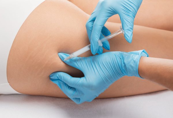 Are Butt Fillers a Good Choice for Fuller Curves?