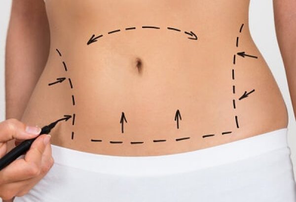Top-Ranked Specialists for Plastic Surgery Tummy Tuck Dubai