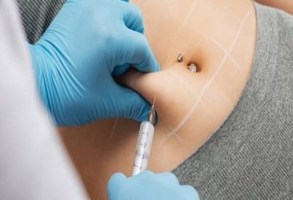 Do Fat Injections Improve Skin Quality?