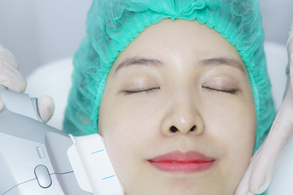 When Is the Right Age to Start HIFU Treatment?