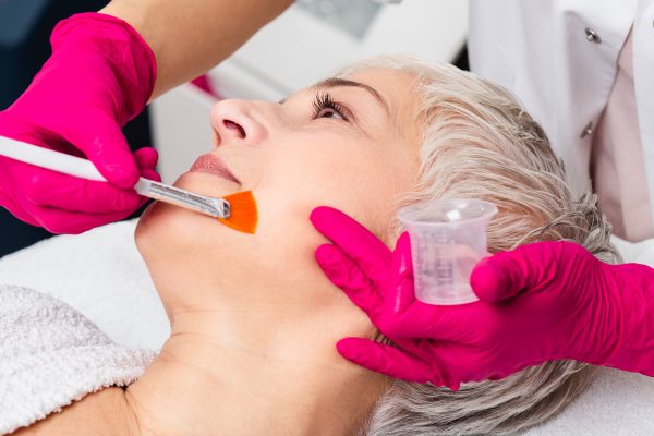 Which Type of Chemical Peel Could Match Your Skin Concerns?
