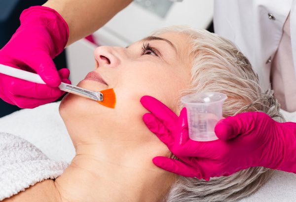 Which Type of Chemical Peel Could Match Your Skin Concerns?