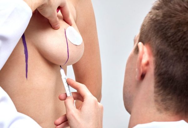 Can Breast Augmentation Help Achieve Perfect Body Symmetry?