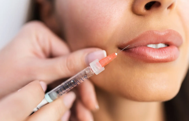 Lip Filler Injections: Before and After Results You Should Know