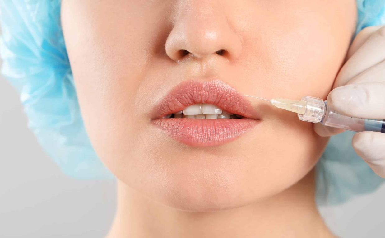 Juvederm Filler: How to Get Natural-Looking Results