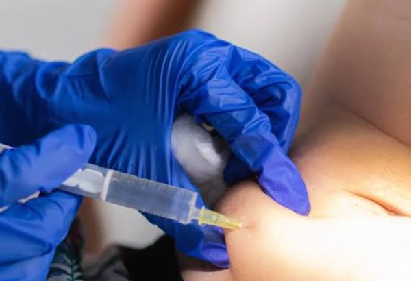 Can Fat Injections Help Achieve Fuller Facial Features?