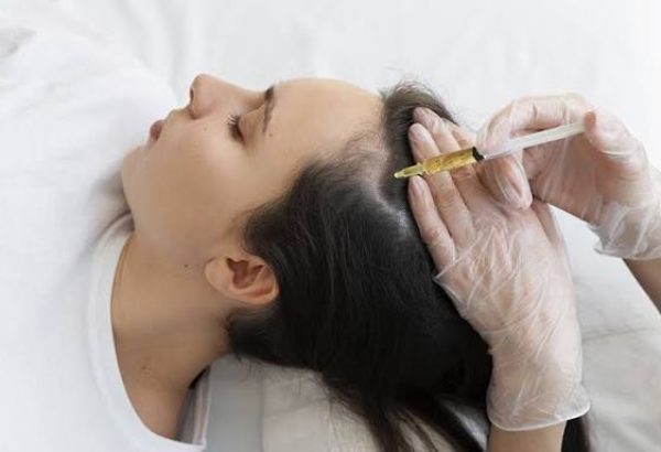 Does PRP Hair Treatment Encourage New Hair Growth?