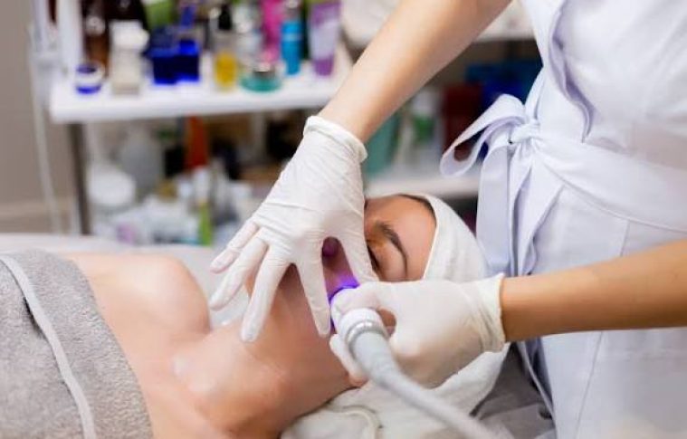Can Radio Frequency For Acne Scars Help Deep Scars?