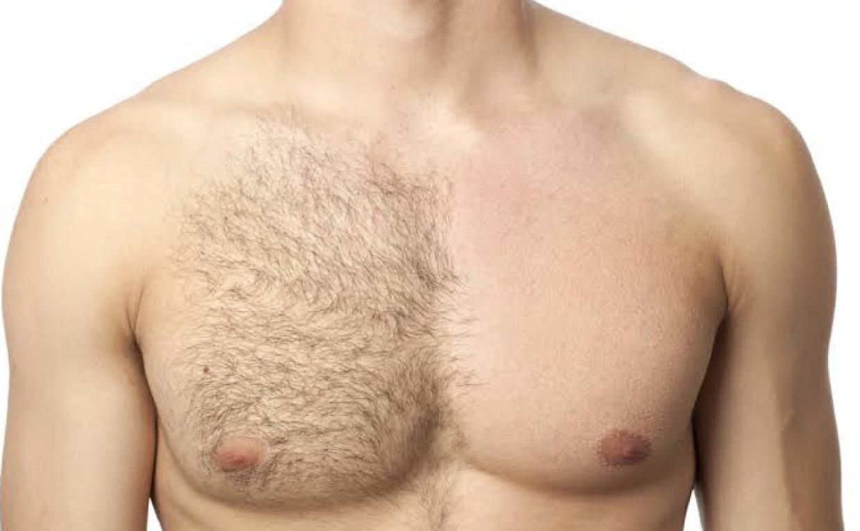 What Body Areas Can Be Used for Hair Transplantation?