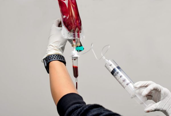 Can Ozone Therapy Be Performed After Surgery?