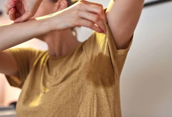 Can Botox for Sweat Glands Control Excessive Sweating?