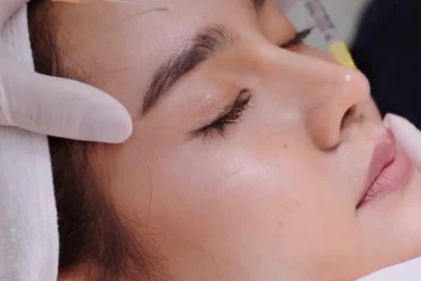 How Does the Type of Filler Affect Fillers Injection Cost?