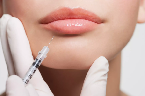 How Much Is the Lip Filler Price for 0.5ml?