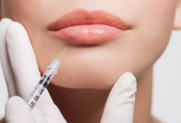 How Much Is the Lip Filler Price for 0.5ml?
