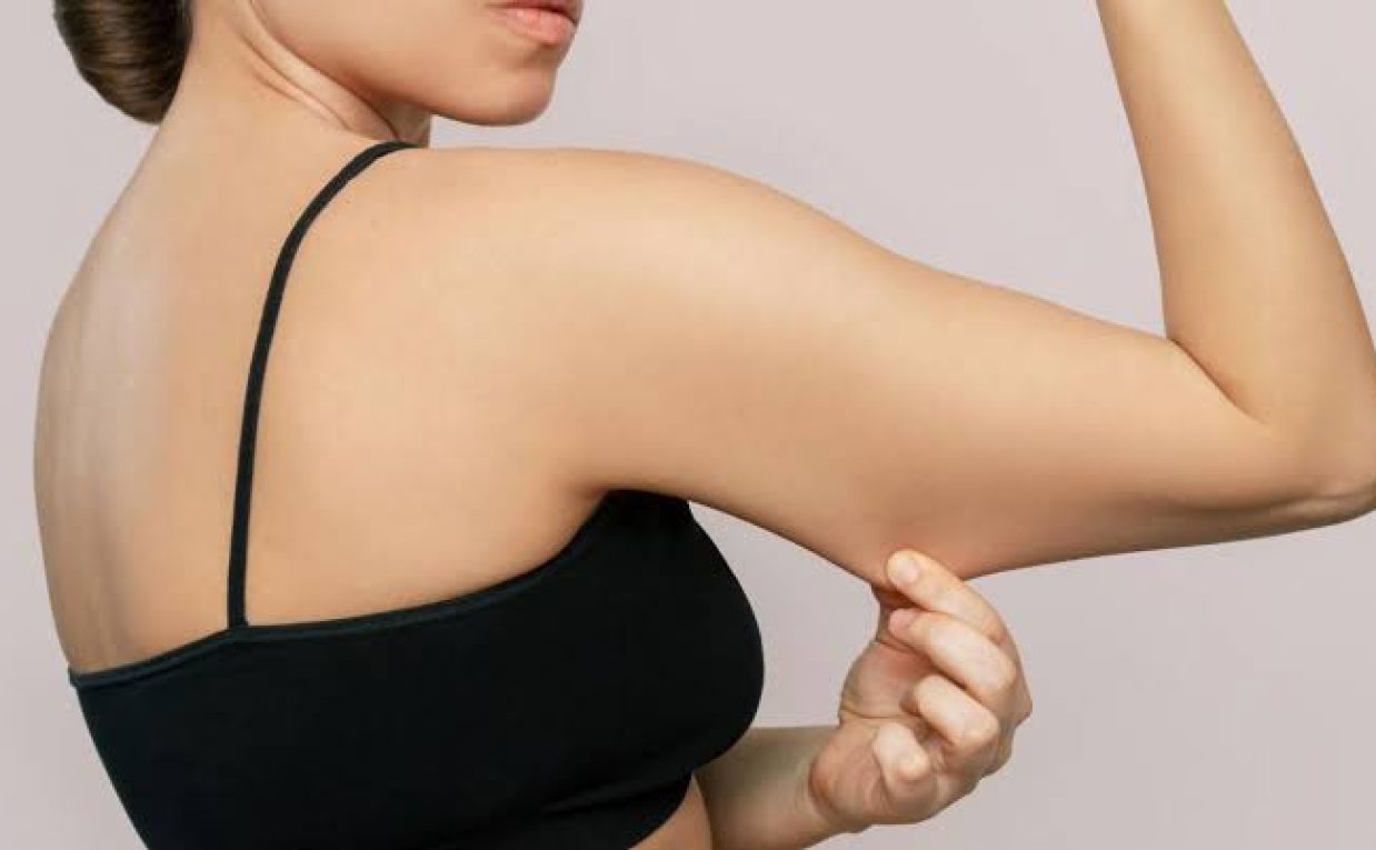 Can Brachioplasty Improve the Shape of Upper Arms?