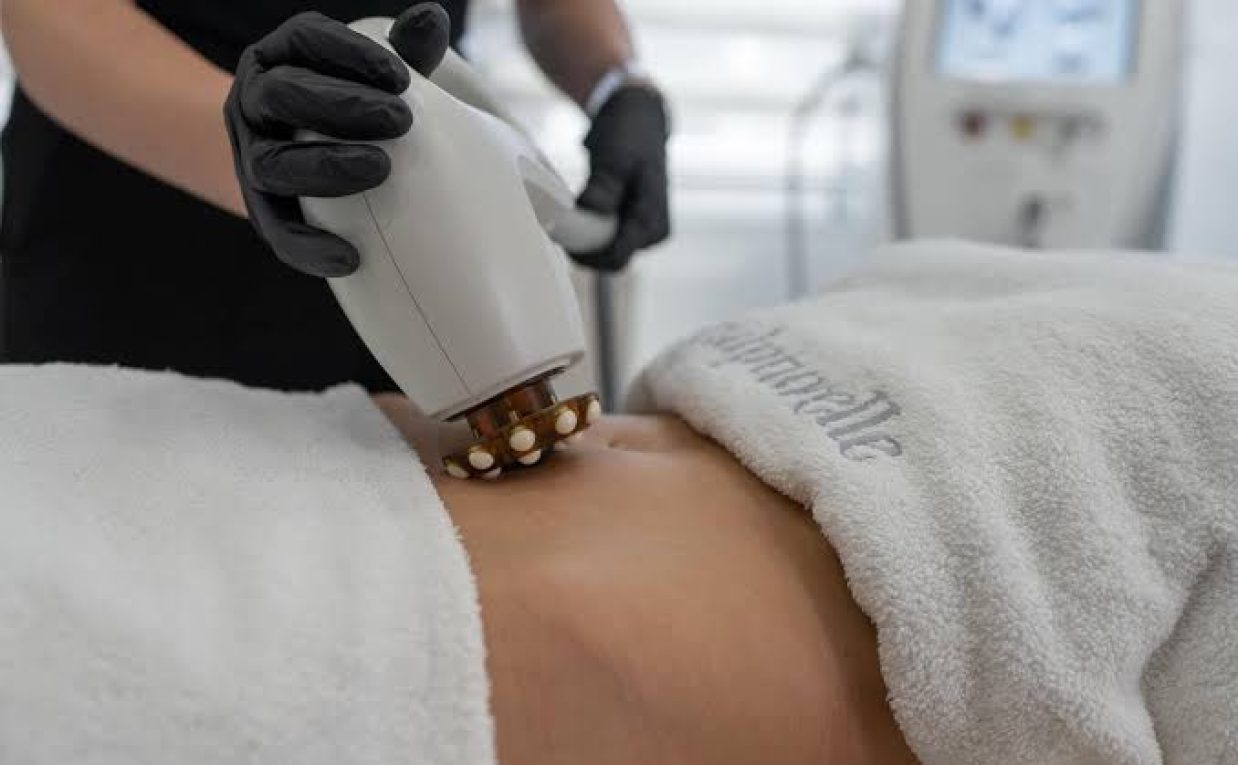 What Happens During a Cellulite Treatment Session?