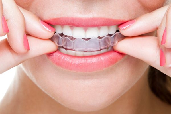 Can Mouth Guards Protect Teeth From Night Grinding?