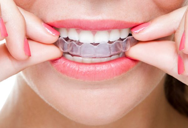 Can Mouth Guards Protect Teeth From Night Grinding?