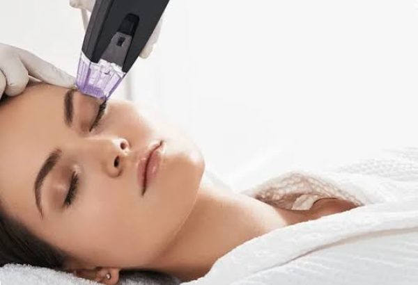 What Makes Morpheus8 Treatment Popular for Facial Renewal?
